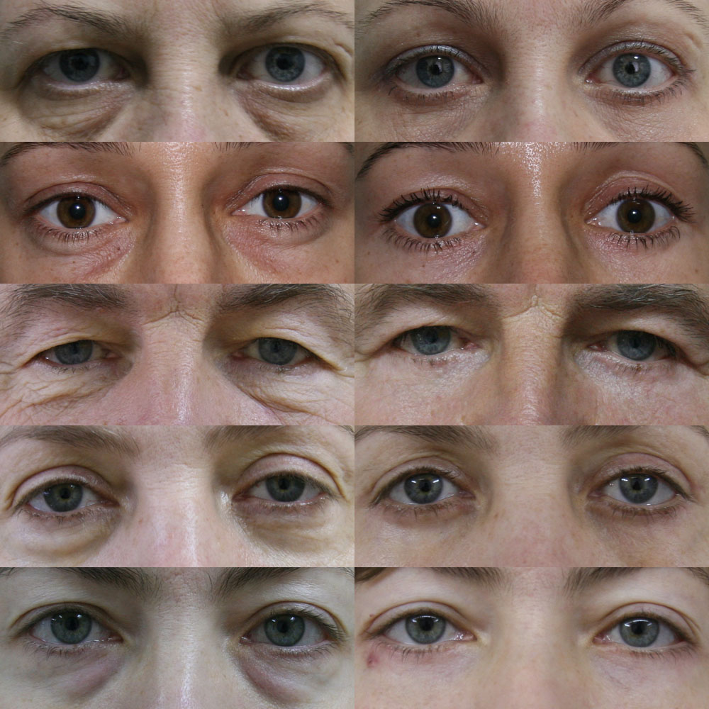 Plastic & Cosmetic Surgery Safety Endorsement [AMB-19]
